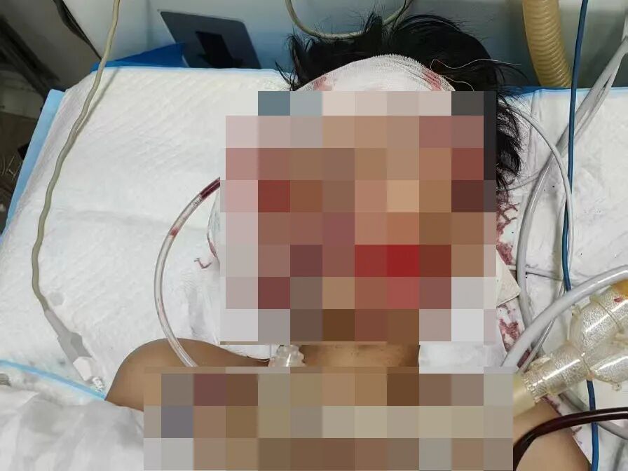 14岁骑车带人撞上半挂车,这些未成年人事故案例要警惕